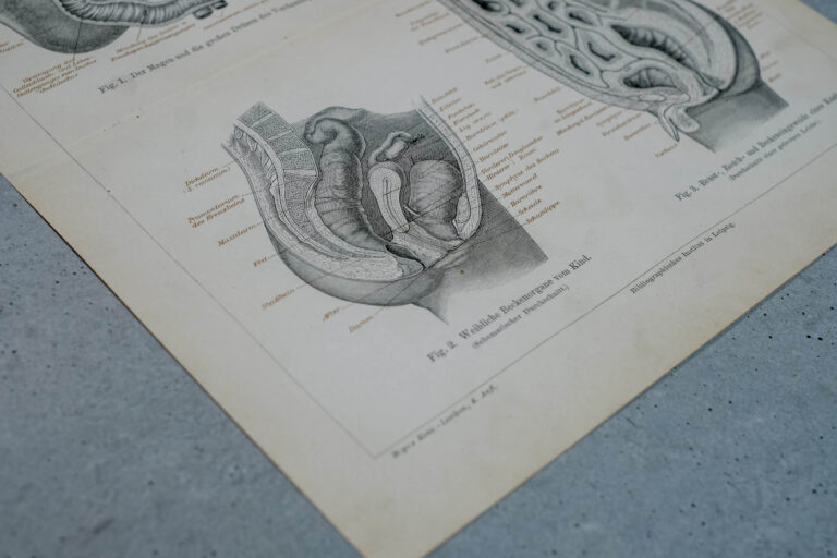 Human Digestive System — Original Lithograph, 1888